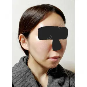 口コミ