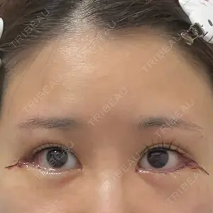 くさのたろうクリニック口コミ