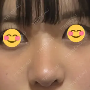 LUHO（ルホ）美容外科口コミ