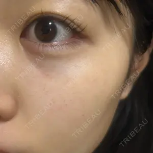 ルラ美容クリニック ルラ美容クリニック 池袋院口コミ