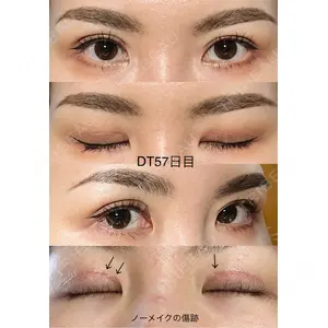 BIANCA CLINIC BIANCA銀座口コミ