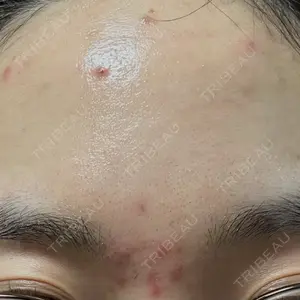 口コミ