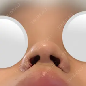 口コミ