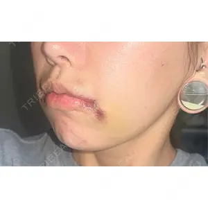 R Beauty CLINIC R Beauty CLINIC 銀座院口コミ