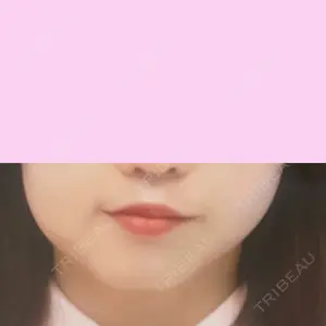 DMTC美容皮膚科 DMTC美容皮膚科 日本橋院口コミ