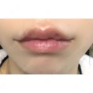 口コミ