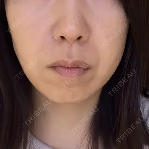 HINATA クリニック口コミ