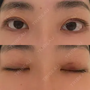 水の森美容クリニックの口コミ
