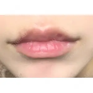 口コミ