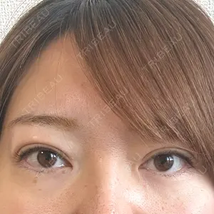 アリエル美容クリニック アリエル美容クリニック 大宮院口コミ