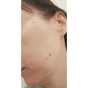APスキンクリニック銀座口コミ