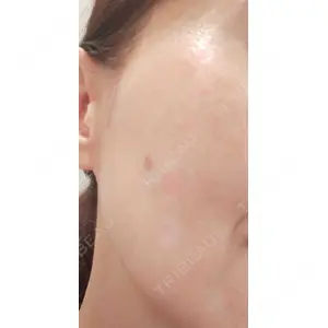 APスキンクリニック銀座口コミ