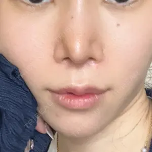 口コミ