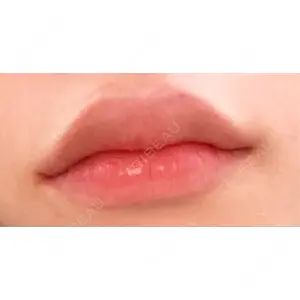 アネシス美容クリニック口コミ