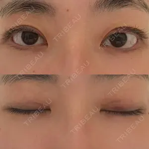 水の森美容クリニックの口コミ