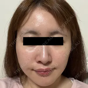 東京シンデレラ美容外科 東京シンデレラ美容外科 池袋院口コミ