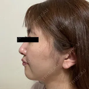 東京シンデレラ美容外科 東京シンデレラ美容外科 池袋院口コミ