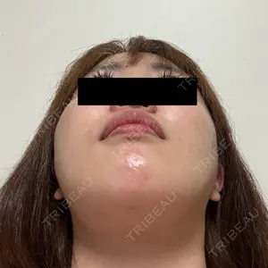 東京シンデレラ美容外科 東京シンデレラ美容外科 池袋院口コミ