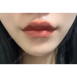 HAAB×DREAM BEAUTY CLINIC 大阪梅田院の
