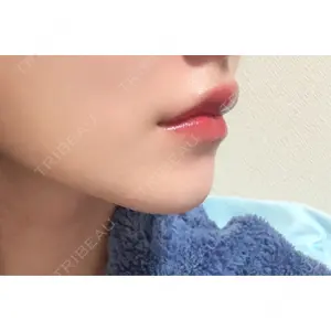 HAAB×DREAM BEAUTY CLINIC 大阪梅田院の