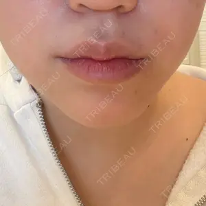 メディカルアルファクリニック口コミ