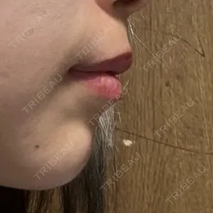 口コミ