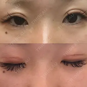 口コミ