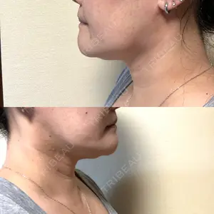 銀座マイアミ美容外科の