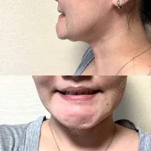 銀座マイアミ美容外科の