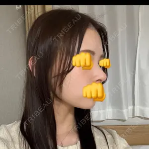 LUHO（ルホ）美容外科口コミ