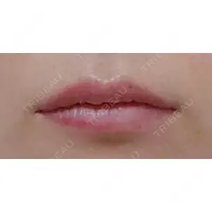 口コミ