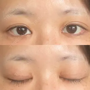東京シンデレラ美容外科 東京シンデレラ美容外科 池袋院口コミ