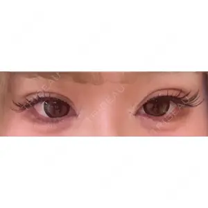 口コミ