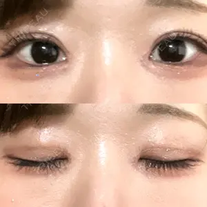 東京シンデレラ美容外科 東京シンデレラ美容外科 池袋院口コミ