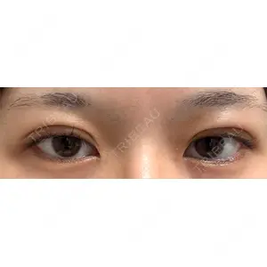 水の森美容クリニックの口コミ