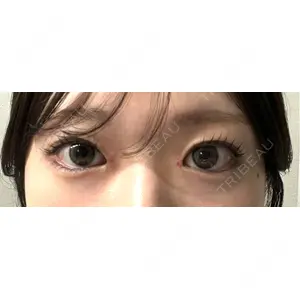 東京シンデレラ美容外科 東京シンデレラ美容外科 池袋院口コミ