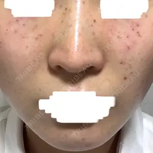 アモーレクリニック アモーレクリニック 名古屋院口コミ
