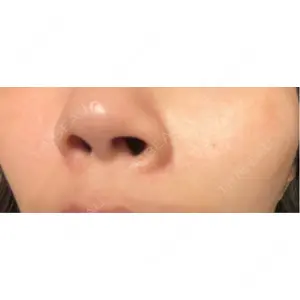 CHARIS BEAUTY CLINIC口コミ