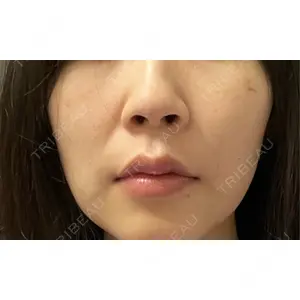 AZ BEAUTY CLINIC口コミ