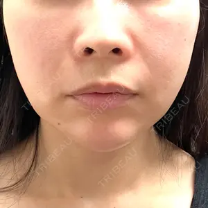 聖心美容クリニック グループ S-Laboクリニック 渋谷院口コミ