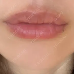 アネシス美容クリニック口コミ