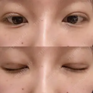 湘南美容クリニック 湘南美容クリニック 柏院口コミ