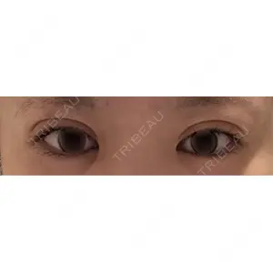 LUHO（ルホ）美容外科口コミ