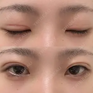 口コミ