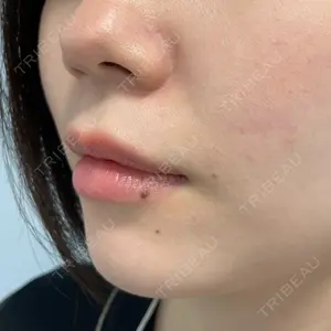 口コミ