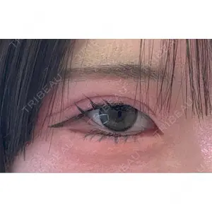 アリエル美容クリニック アリエル美容クリニック 大宮院口コミ