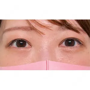 HAAB×DREAM BEAUTY CLINIC HAAB×DREAM BEAUTY CLINIC 大阪梅田院口コミ