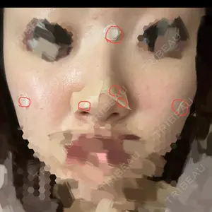口コミ