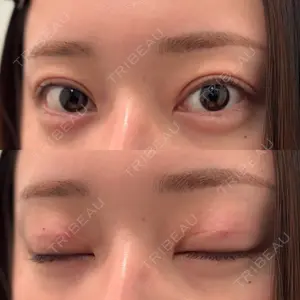 水の森美容クリニックの口コミ