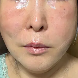 TCB東京中央美容外科 徳島院口コミ
